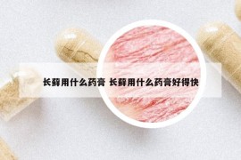 长藓用什么药膏 长藓用什么药膏好得快