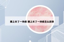 腰上长了一块癣 腰上长了一块癣怎么回事