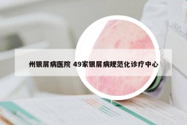 州银屑病医院 49家银屑病规范化诊疗中心