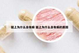 腿上为什么会有癣 腿上为什么会有癣的原因