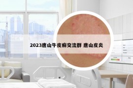 2023唐山牛皮癣交流群 唐山皮炎