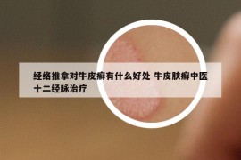 经络推拿对牛皮癣有什么好处 牛皮肤癣中医十二经脉治疗