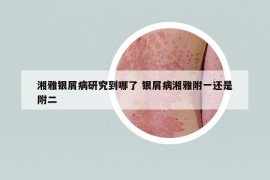 湘雅银屑病研究到哪了 银屑病湘雅附一还是附二