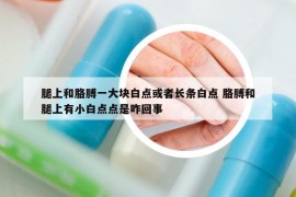 腿上和胳膊一大块白点或者长条白点 胳膊和腿上有小白点点是咋回事