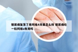 银屑病复发了用阿维A效果怎么样 银屑病吃一粒阿维a有用吗