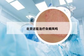 北京还能治疗白癜风吗