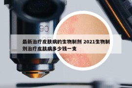 最新治疗皮肤病的生物制剂 2021生物制剂治疗皮肤病多少钱一支