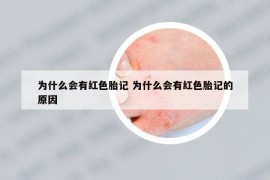 为什么会有红色胎记 为什么会有红色胎记的原因