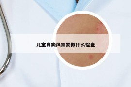 儿童白癜风需要做什么检查