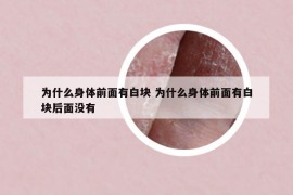 为什么身体前面有白块 为什么身体前面有白块后面没有