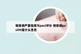 银屑病严重程度与pasi评分 银屑病pasi90是什么意思