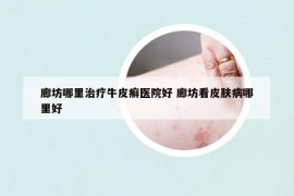 廊坊哪里治疗牛皮癣医院好 廊坊看皮肤病哪里好