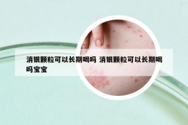 消银颗粒可以长期喝吗 消银颗粒可以长期喝吗宝宝