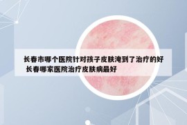 长春市哪个医院针对孩子皮肤淹到了治疗的好 长春哪家医院治疗皮肤病最好