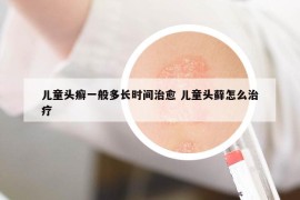 儿童头癣一般多长时间治愈 儿童头藓怎么治疗