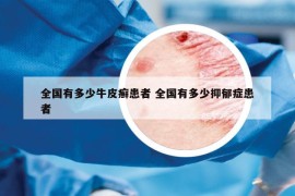 全国有多少牛皮癣患者 全国有多少抑郁症患者