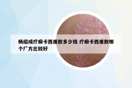 杨绍成疗癣卡西甫散多少钱 疗癣卡西甫散哪个厂方比较好