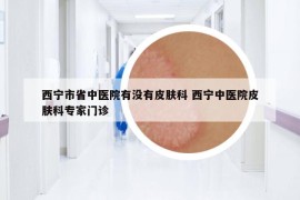 西宁市省中医院有没有皮肤科 西宁中医院皮肤科专家门诊