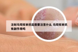 注射乌司奴单抗后需要注意什么 乌司奴单抗有副作用吗