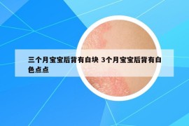 三个月宝宝后背有白块 3个月宝宝后背有白色点点