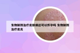 生物制剂治疗皮肤病还可以怀孕吗 生物制剂治疗皮炎