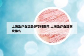上海治疗白斑最好专科医院 上海治疗白斑医院排名