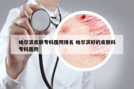 哈尔滨皮肤专科医院排名 哈尔滨好的皮肤科专科医院