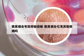 银屑病会导致抑郁症嘛 银屑病会引发其他疾病吗