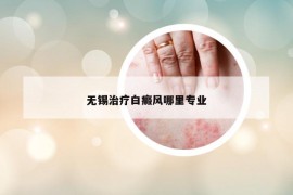 无锡治疗白癜风哪里专业