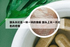 额头长红色一块一块的像癣 额头上长一片红色的疙瘩