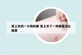 背上长的一小块的癣 背上长了一块癣是怎么回事