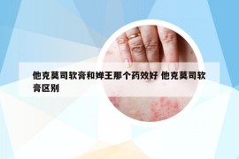 他克莫司软膏和婵王那个药效好 他克莫司软膏区别