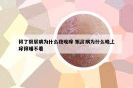 得了银屑病为什么夜晚痒 银屑病为什么晚上痒得睡不着