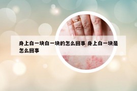 身上白一块白一块的怎么回事 身上白一块是怎么回事