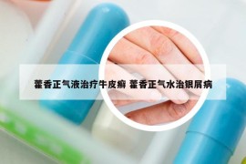 藿香正气液治疗牛皮癣 藿香正气水治银屑病