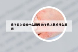 孩子头上长癣什么原因 孩子头上起癣什么原因