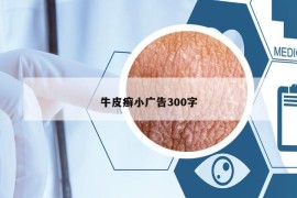 牛皮癣小广告300字