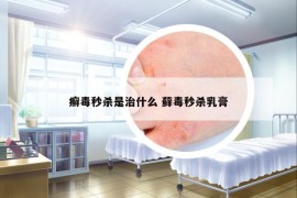 癣毒秒杀是治什么 藓毒秒杀乳膏