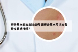 柳条煮水能治皮肤病吗 用柳条煮水可以治各种皮肤病行吗?