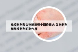 免疫制剂和生物制剂哪个副作用大 生物制剂和免疫制剂的副作用