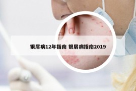 银屑病12年指南 银屑病指南2019