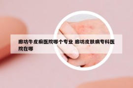 廊坊牛皮癣医院哪个专业 廊坊皮肤病专科医院在哪