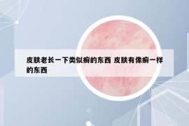 皮肤老长一下类似癣的东西 皮肤有像癣一样的东西