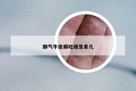 脚气牛皮癣吃维生素几