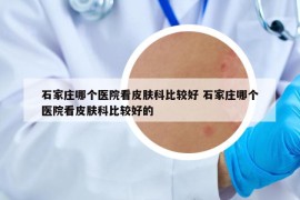 石家庄哪个医院看皮肤科比较好 石家庄哪个医院看皮肤科比较好的