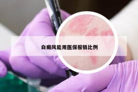 白癜风能用医保报销比例