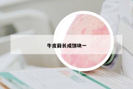 牛皮藓长成饼块一