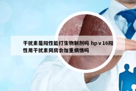 干扰素是阳性能打生物制剂吗 hpⅴ16阳性用干扰素同房会加重病情吗