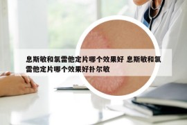 息斯敏和氯雷他定片哪个效果好 息斯敏和氯雷他定片哪个效果好扑尔敏