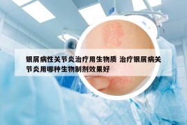 银屑病性关节炎治疗用生物质 治疗银屑病关节炎用哪种生物制剂效果好